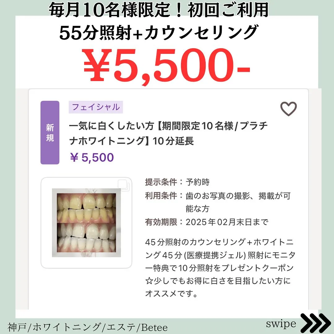 @whitening_betee ホワイトニング