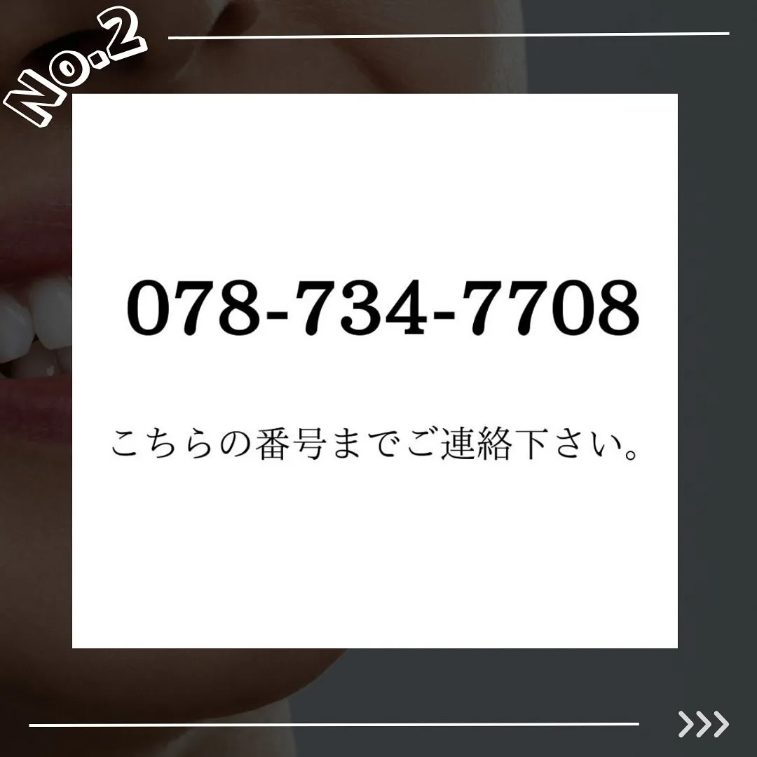 @whitening_betee ホワイトニング