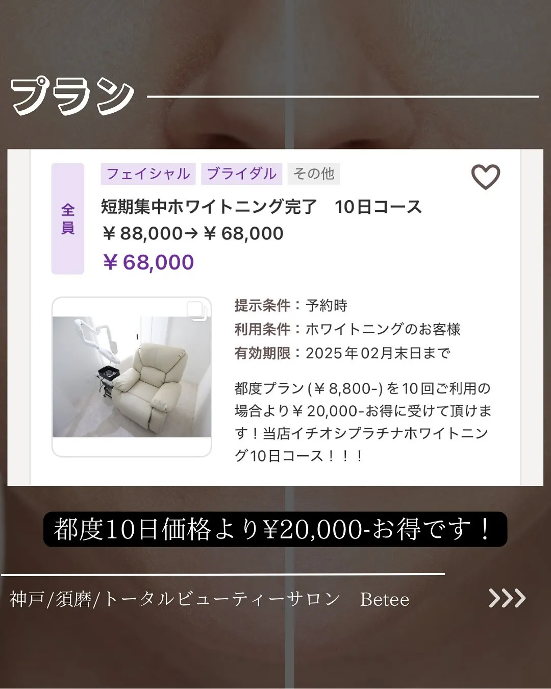 @whitening_betee ホワイトニング