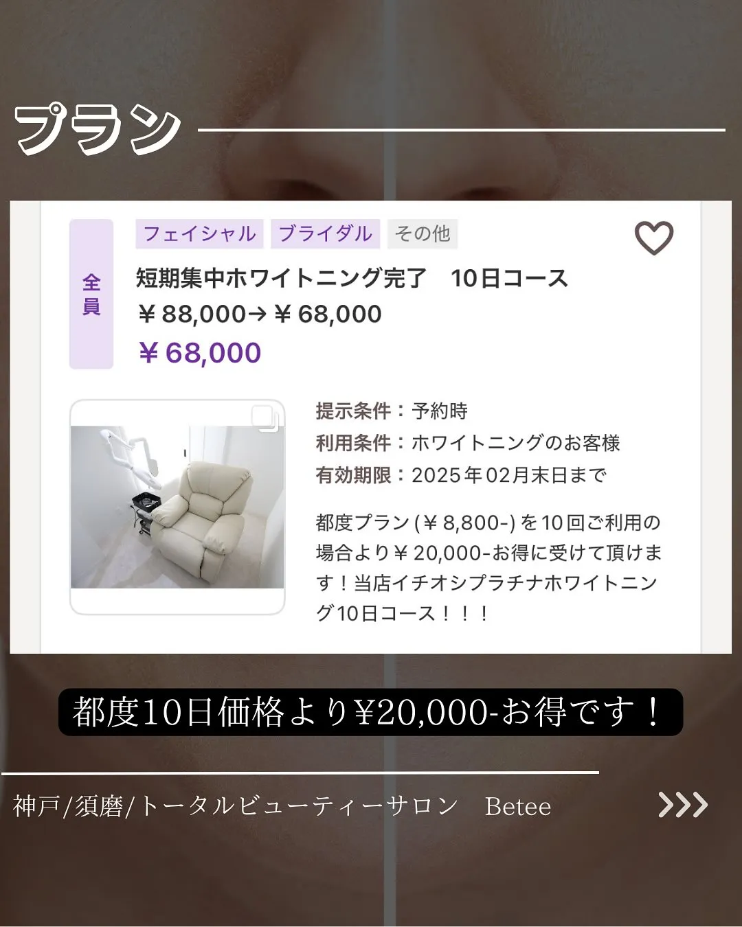 @whitening_betee ホワイトニング