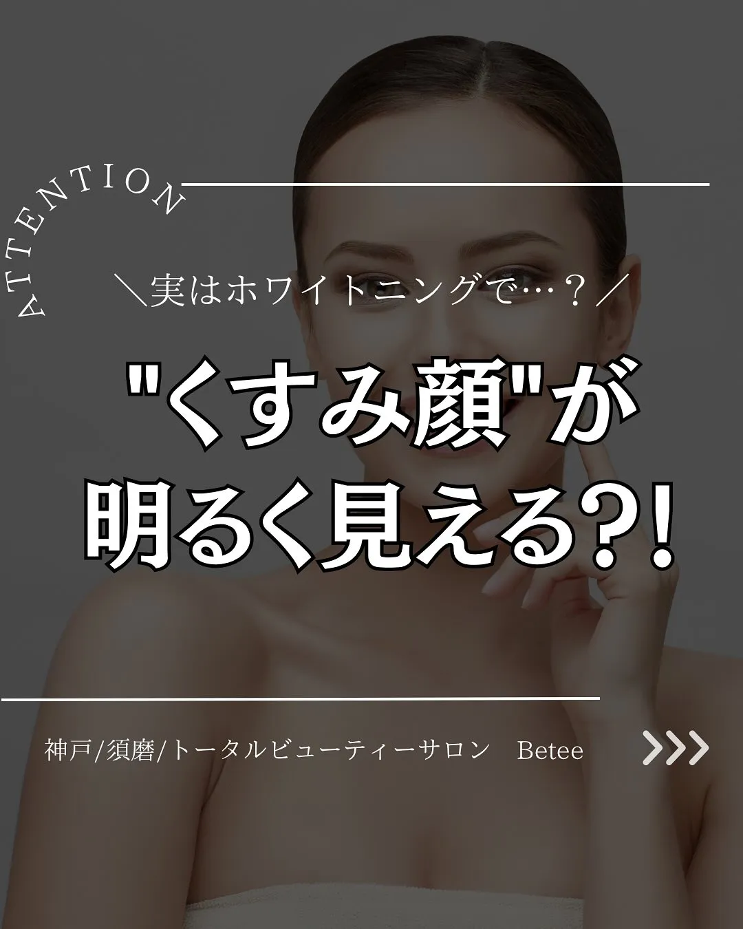 @whitening_betee ホワイトニング