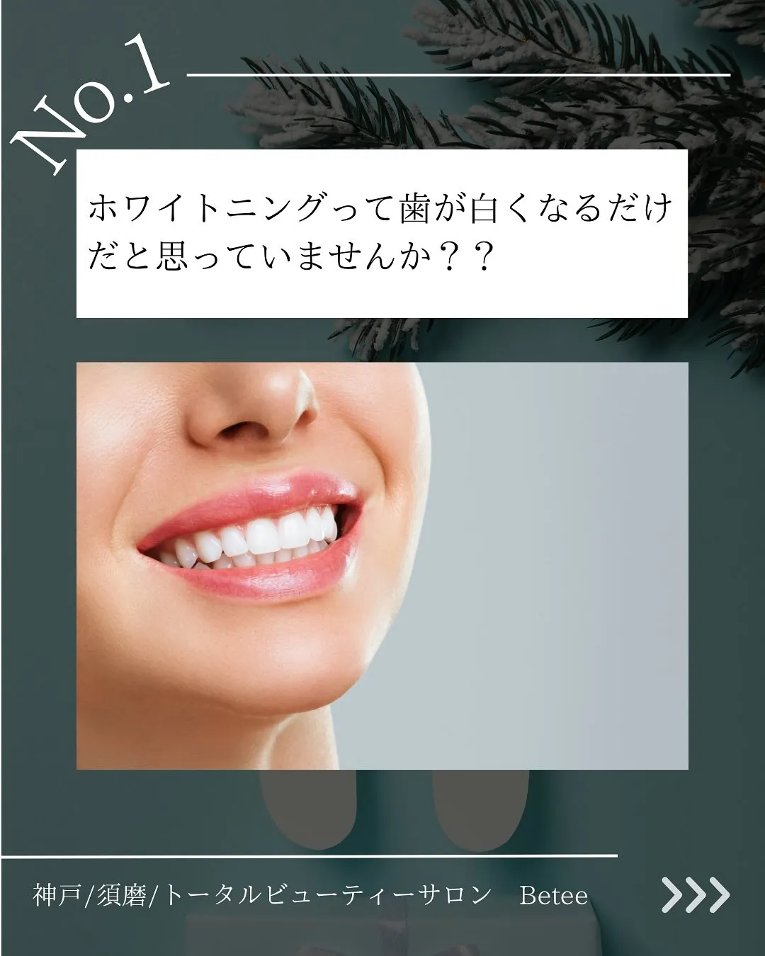 @whitening_betee ホワイトニング