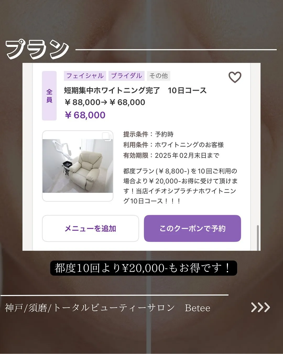 @whitening_betee ホワイトニング