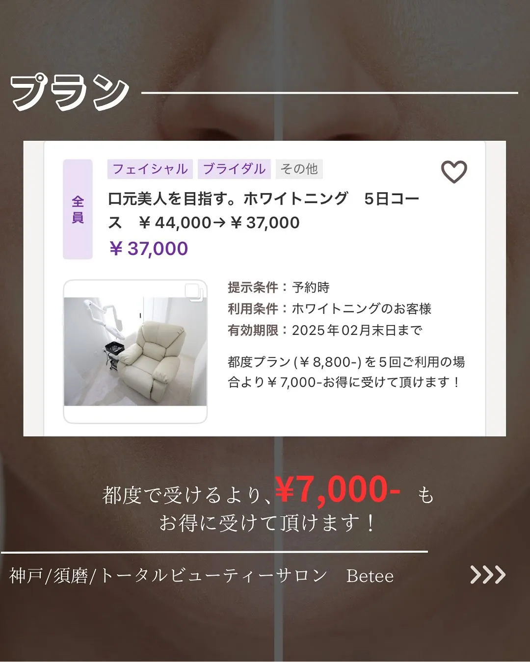 @whitening_betee ホワイトニング