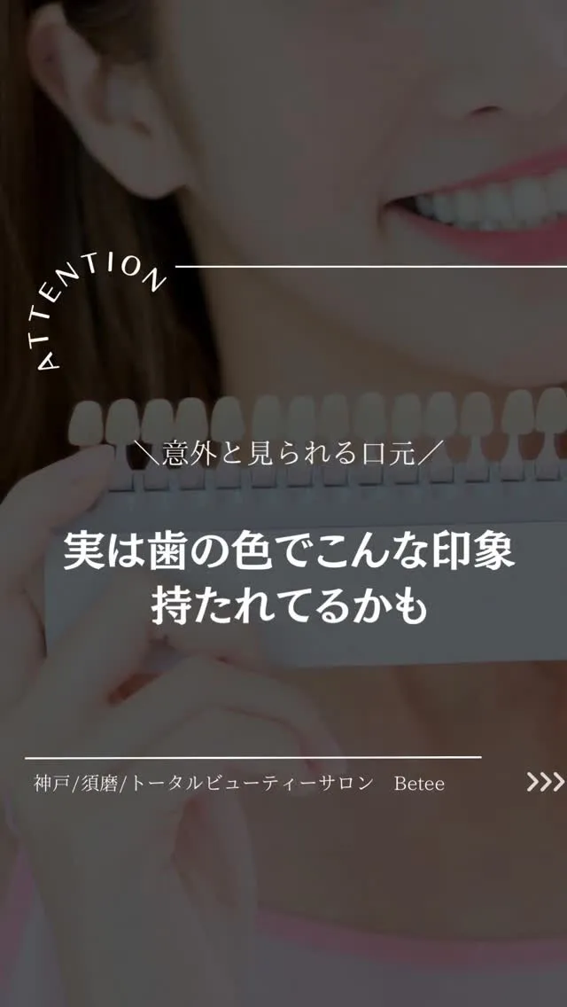 【実は歯の色でこんな印象持たれてるかも🦷】