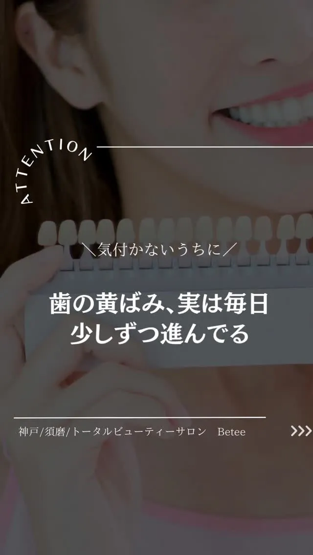 【歯の黄ばみ、実は毎日少しずつ進んでます🦷】